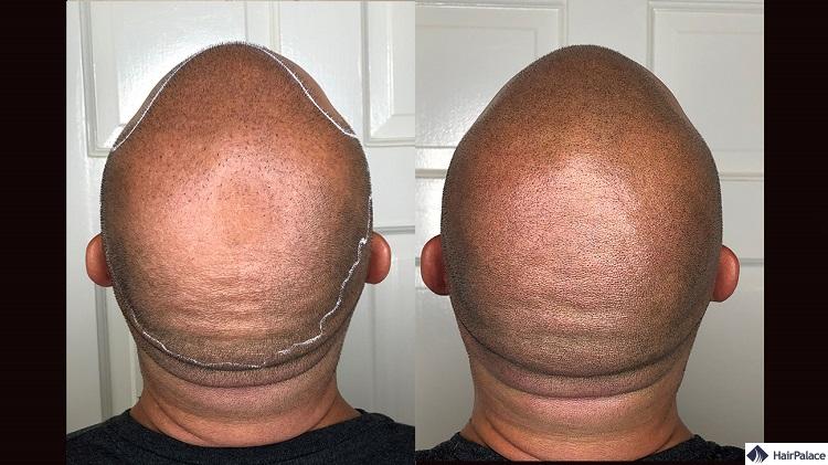 Haar Tattoo für Männer